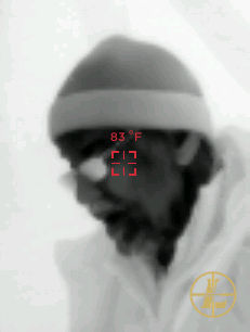 Rainer thermal image.